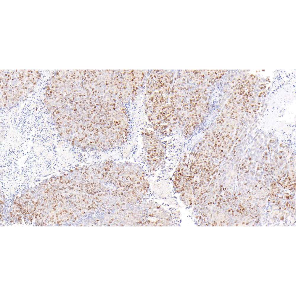Anti -Ki67 PAB de lapin pour la recherche sur le cancer IHC si l'anticorps principal