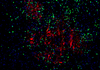 TSA Fluorescence Double Kit de coloration Tyramide Amplification du signal d'immunofluorescence Réactif