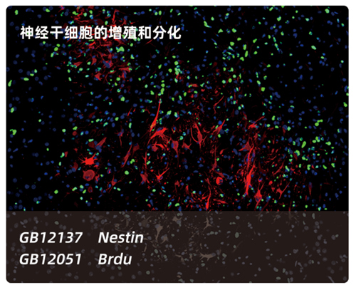 Kit de coloration double à double fluorescence de Tsaplus pour la coloration double immunofluorescence de sections de paraffine