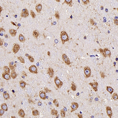 PAB de lapin anti-neurotensin pour WB IHC si l'anticorps polyclonal