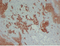 //iororwxhrkjnln5q-static.micyjz.com/cloud/lnBpjKnjlkSRqippjkimiq/6b7a9e3832fe09c398a8eb6375b5aea8-60-60.png