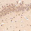 Anti-cholique acétyltransférase pabp de lapin pour le rat de la souris IHC si l'anticorps principal