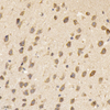 GB11144 PAB anticorps anti-nmdar1 de lapin 1