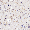 Anti-GDNF de lapin PAB Anticorps polyclonal immunohistochimique
